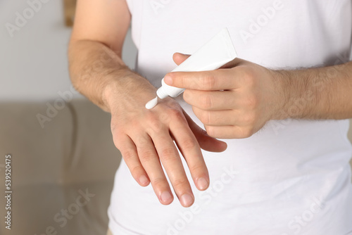 Man applying cream onto hand at home, closeup