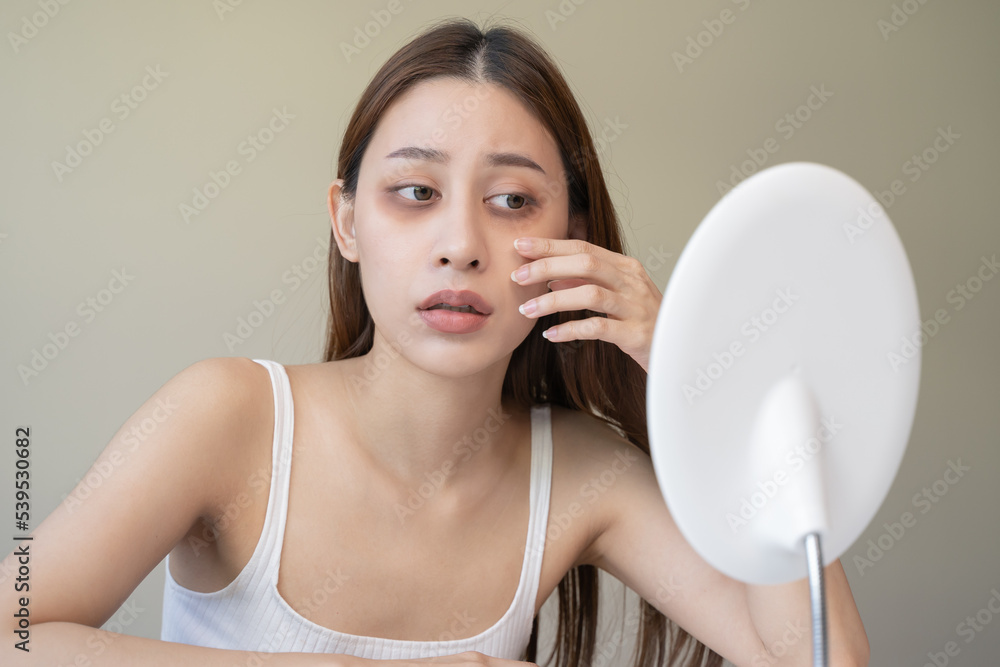 lack of sleep problem, Worried Asian young woman pointing finger at dark circles under her eyes lack of sleep problem, Worried Asian young woman pointing finger at dark circles under her eyes