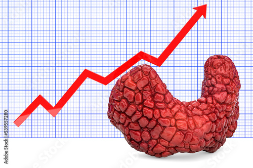 Foto Thyroid gland with growing chart. 3D rendering