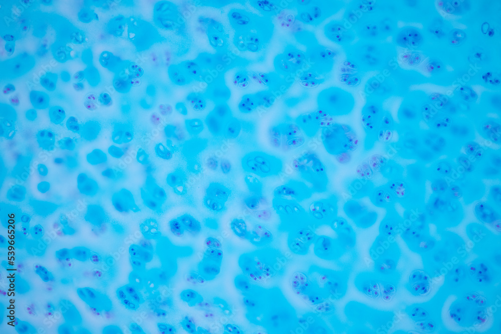 Hyaline cartilage, Elastic cartilage and Bone Human under the microscope in Lab. Hyaline cartilage, Elastic cartilage and Bone Human under the microscope in Lab.
