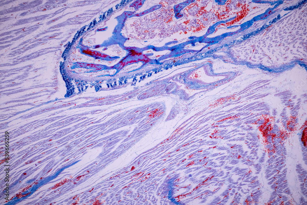 Hyaline cartilage, Elastic cartilage and Bone Human under the microscope in Lab. Hyaline cartilage, Elastic cartilage and Bone Human under the microscope in Lab.