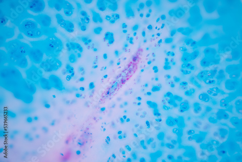 Hyaline cartilage, Elastic cartilage and Bone Human under the microscope in Lab. photo