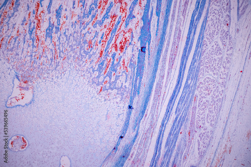 Hyaline cartilage, Elastic cartilage and Bone Human under the microscope in Lab. photo