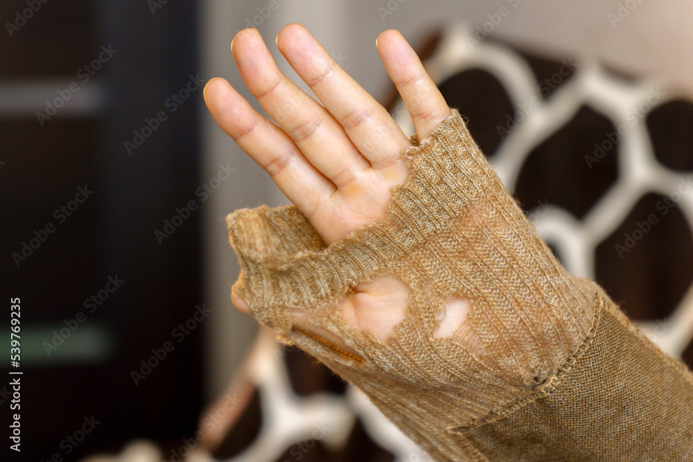Mending clothes. Repairing woolen sweaters, shopping less concept. Selective focus - obrazy, fototapety, plakaty 