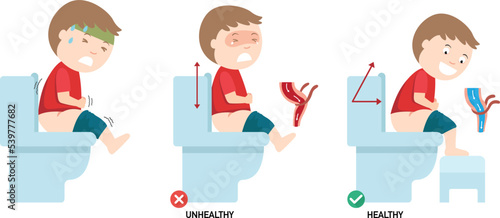 unhealthy vs healthy positions for defecate illustration vector