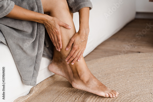 Sclerotherapy procedure at visiting vascular surgeon doctor. Deep vein thrombosis and varicose of african woman. Girl touching her legs and looking at veins. photo