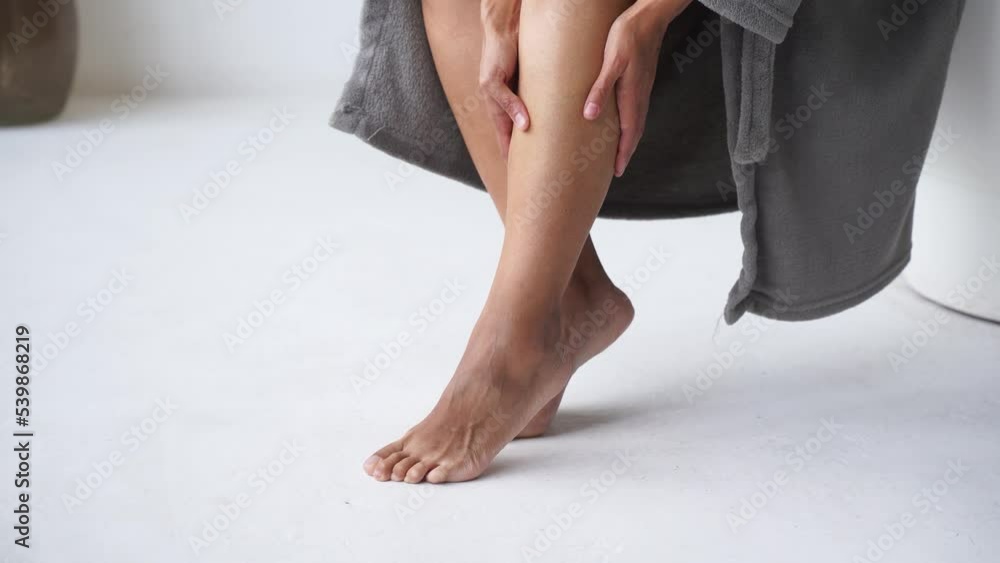 Deep vein thrombosis and varicose of african woman. Girl touching and