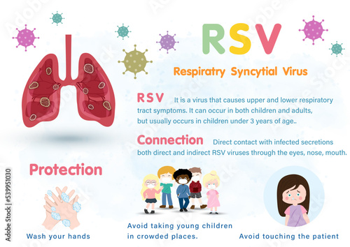 RSV, Respiratory syncytial virus infographic medical illustration.