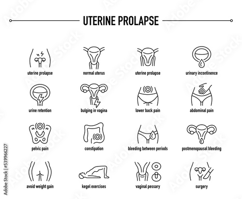 Uterine Prolapse vector icon set. Line editable medical icons. photo