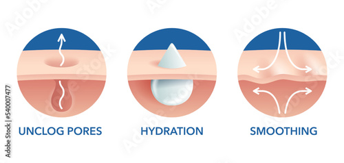 Facial acne cleanser 3D icons set 