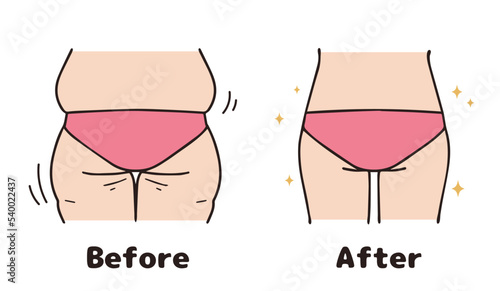 Butt diet, before and after set.