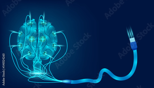 Cartoon drawing of a brain with transcranial magnetic stimulation