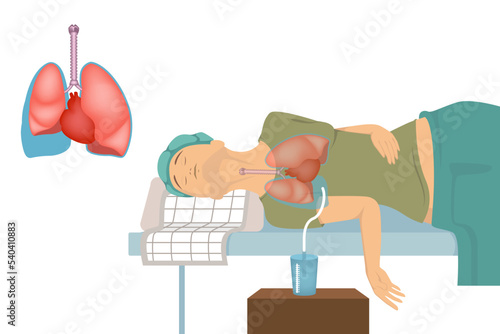 pleural effusion. Patient with a catheter in the lungs. Procedure with pumping out excess fluid. Vector illustration photo
