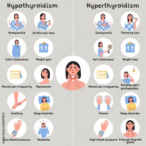 Hypothyroidism and hyperthyroidism symptoms. Thyroid gland problem with endocrinology system, hormone production. Infografic with woman character. Flat vector medical illustration photo