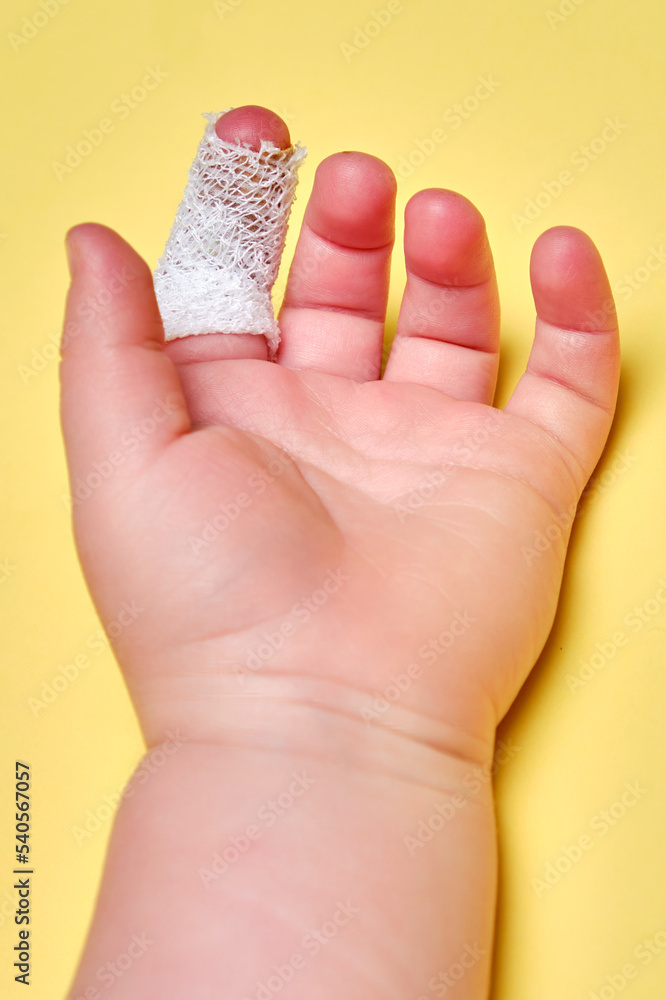 Baby s hand with a bandaged finger on a yellow studio background, close-up. Injured index finger of a child wrapped in a white bandage. Kid boy aged one year and three months