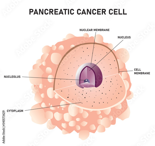 Pancreatic Cancer Cell