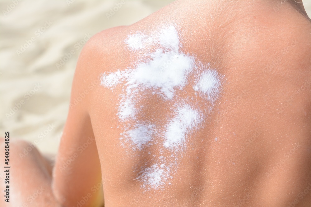 Child with sunscreen on back at beach, closeup Child with sunscreen on back at beach, closeup