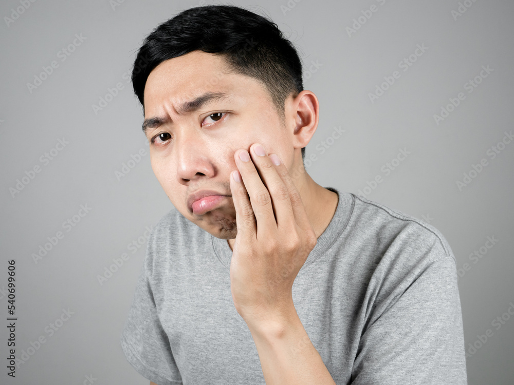 Close up asian man grey shirt feels worried about acne of his face isolated Close up asian man grey shirt feels worried about acne of his face isolated