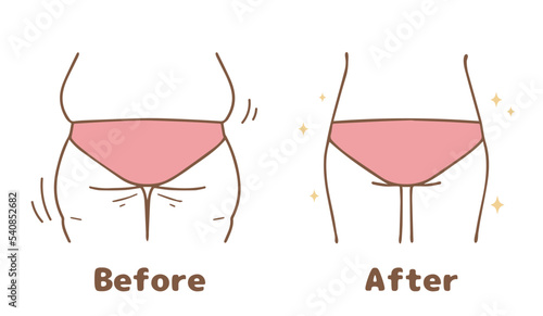 Butt diet, before and after set.