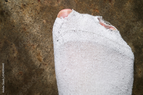 Εκτύπωση καμβά Man toes poking through holes in white socks, hardship concept