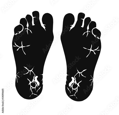 Deep moisturising foot cream icon - gel that soften hard dry and cracked skin