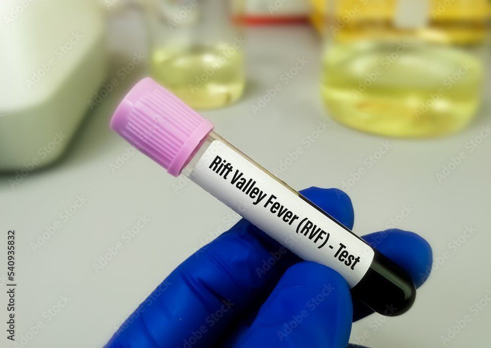 Rift valley fever virus test, an RNA virus of Bunyaviridae family, transmitted from infected animals by mosquito bite or air which is responsible for Rift valley fever. Rift valley fever virus test, an RNA virus of Bunyaviridae family, transmitted from infected animals by mosquito bite or air which is responsible for Rift valley fever.