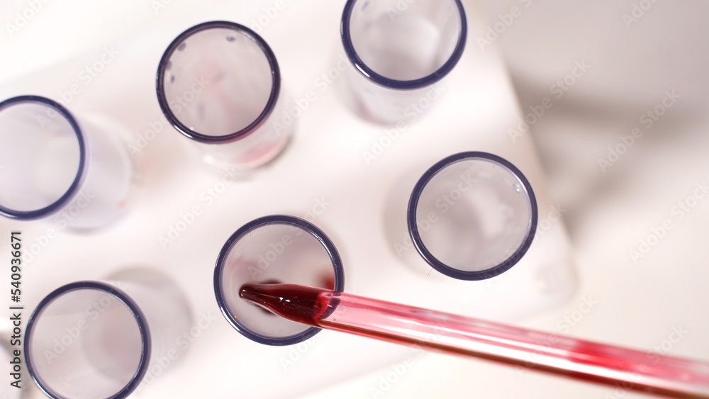 Blood test. Pipette with drop of blood. Chemist or medicine consistently and adds red blood in tubes Blood test. Pipette with drop of blood. Chemist or medicine consistently and adds red blood in tubes