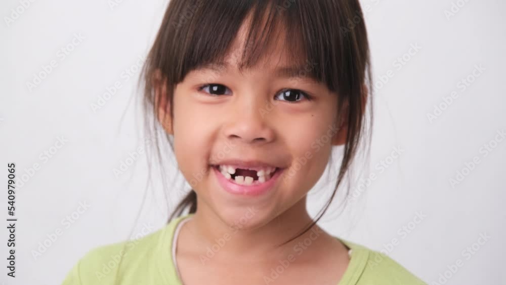 Portrait of an Asian girl with broken upper baby teeth and first permanent teeth. Friendly little girl showing her broken teeth isolated on white background. Portrait of an Asian girl with broken upper baby teeth and first permanent teeth. Friendly little girl showing her broken teeth isolated on white background.