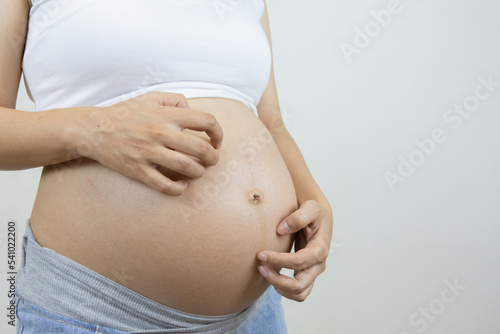 Pregnant women have itchy skin, which is the cause of pregnant women's problem stripes.