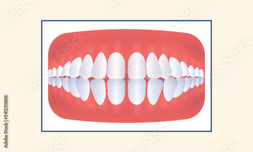 Excessive Spacing Teeth Icon On Yellow Background.