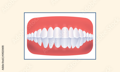 Crowding Human Teeth Icon Over Yellow Background.