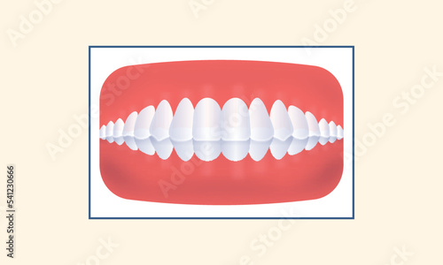 Crossbite Teeth Icon Against Yellow Background.