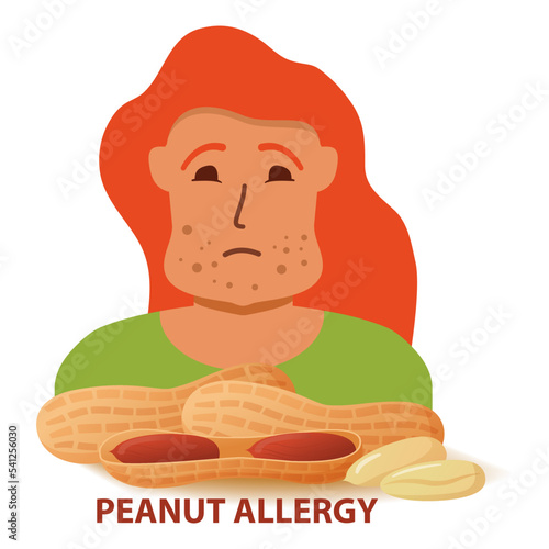 Nut allergy symptoms problem .Swollen man character.Allergic reaction to peanuts girl.Flat illustration vector.Isolated on a white background.