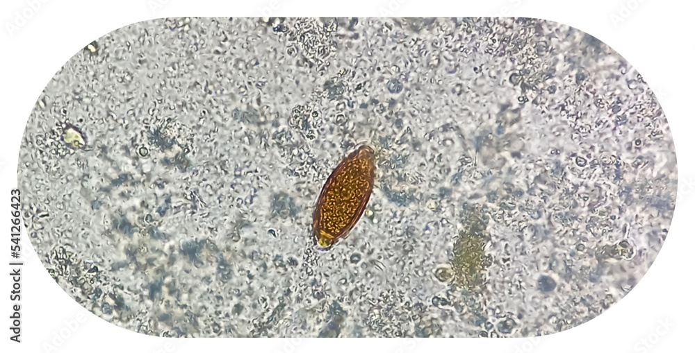 Fototapeta premium Egg of Trichuris trichiura (whipworm) in stool, analyze by microscope