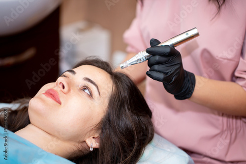 Treatment of the scalp for hair loss, alopecia. A trichologist doctor makes a dermapen procedure on the patient's head. Vitamin injections to improve hair growth. photo