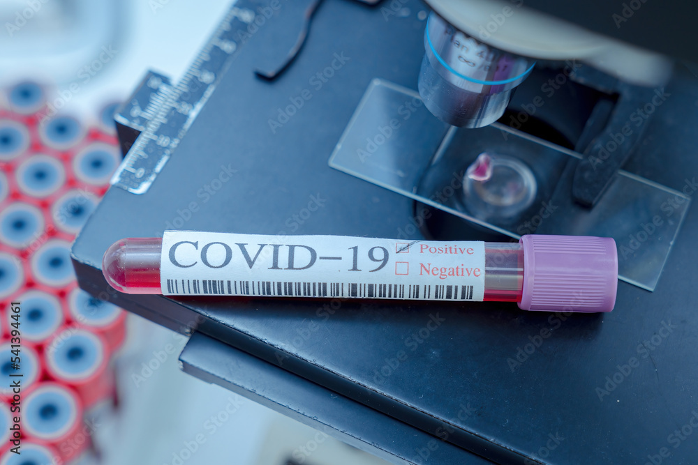 Blood test samples tube, reagent testing tube and swab collection kit in the laboratory, Coronavirus testing process. ,PCR DNA testing protocol process.