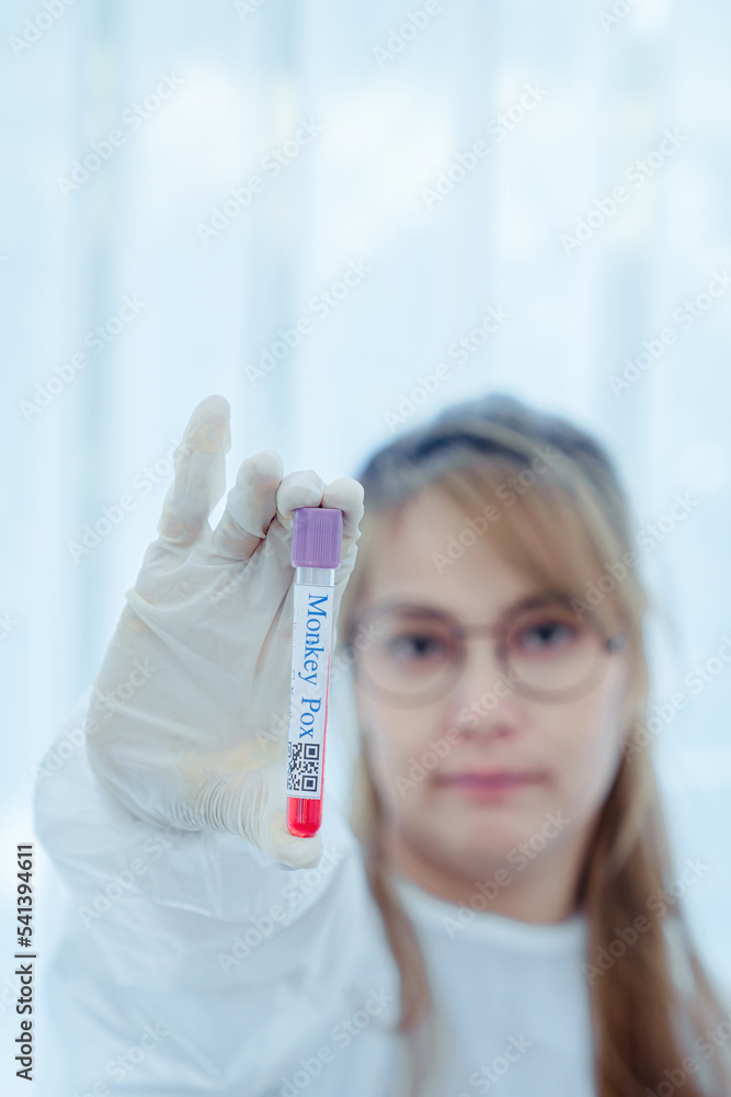 Monkey pox PCR test tube in doctors hand, medical worker in face mask