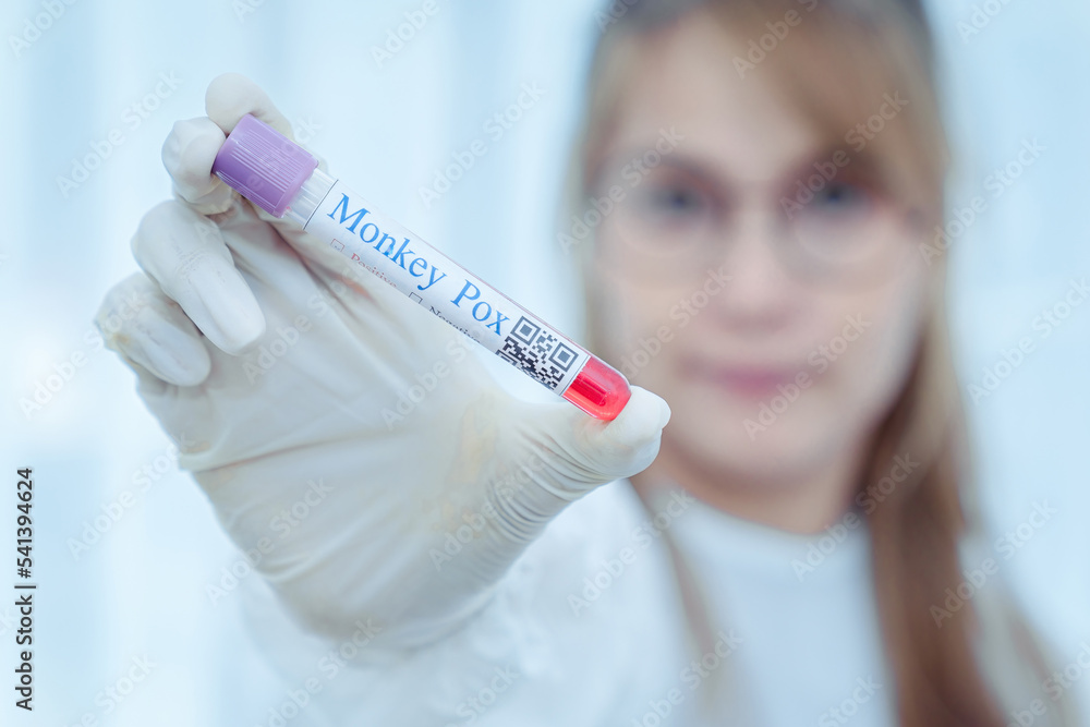 Monkey pox PCR test tube in doctors hand, medical worker in face mask shows swab collection kit for smallpox virus diagnosis and monkeypox research. Concept of monkey pox testing, care and health. Monkey pox PCR test tube in doctors hand, medical worker in face mask shows swab collection kit for smallpox virus diagnosis and monkeypox research. Concept of monkey pox testing, care and health.