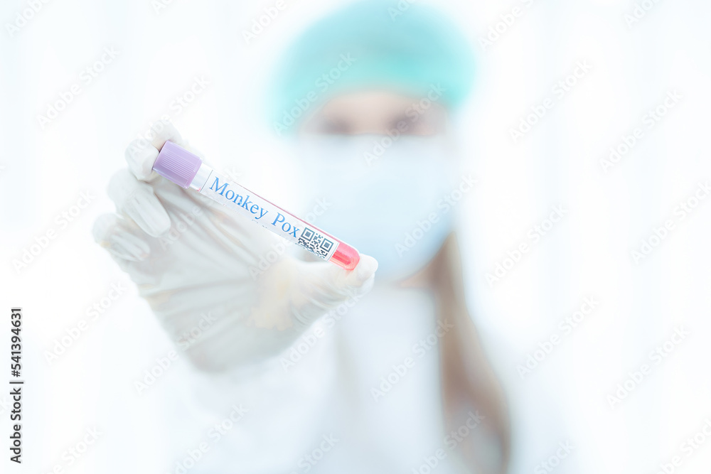Monkey pox PCR test tube in doctors hand, medical worker in face mask shows swab collection kit for smallpox virus diagnosis and monkeypox research. Concept of monkey pox testing, care and health. Monkey pox PCR test tube in doctors hand, medical worker in face mask shows swab collection kit for smallpox virus diagnosis and monkeypox research. Concept of monkey pox testing, care and health.