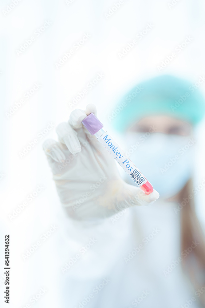 Monkey pox PCR test tube in doctors hand, medical worker in face mask shows swab collection kit for smallpox virus diagnosis and monkeypox research. Concept of monkey pox testing, care and health. Monkey pox PCR test tube in doctors hand, medical worker in face mask shows swab collection kit for smallpox virus diagnosis and monkeypox research. Concept of monkey pox testing, care and health.