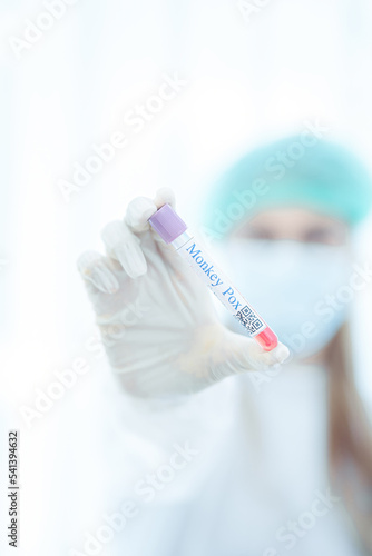 Monkey pox PCR test tube in doctors hand  medical worker in face mask shows swab collection kit for smallpox virus diagnosis and monkeypox research. Concept of monkey pox testing  care and health.