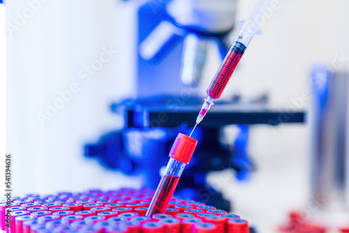 Tableau sur toile Blood test samples tube, reagent testing tube and swab collection kit in the laboratory,  Monkey pox  testing process