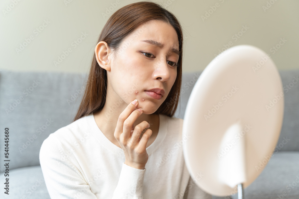 Asian young woman worry about acne on her face after wear face mask. Asian young woman worry about acne on her face after wear face mask.