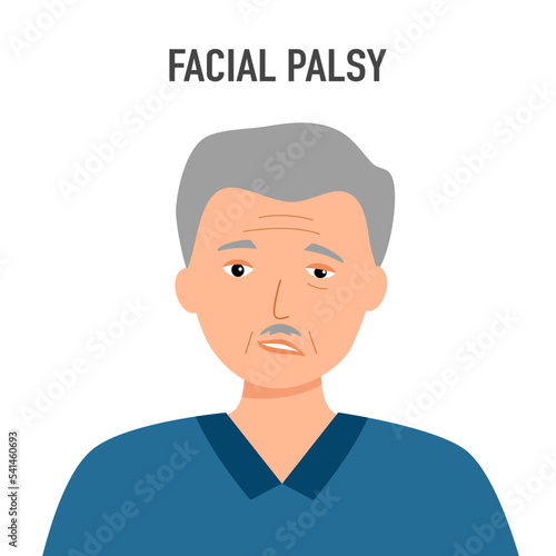 Senior facial nerve paralysis concept vector illustration. Face palsy.