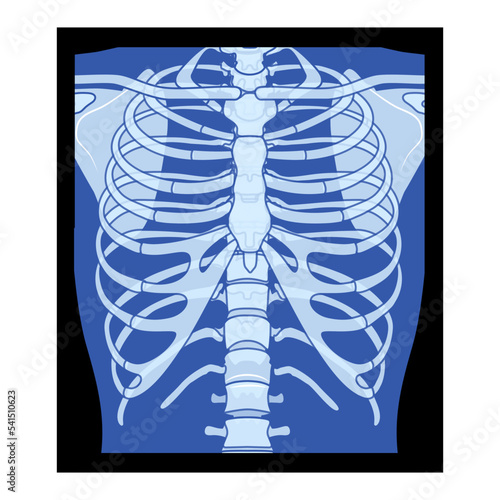 X-Ray Rib cage Skeleton Human body - chest, vertebra, Bones adult people roentgen front view. 3D realistic flat blue color concept Vector illustration of medical anatomy isolated on black background