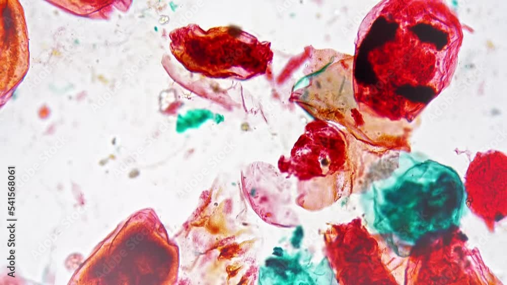 Macro footage of rotifera whole mount under laboratory microscope 200x ...