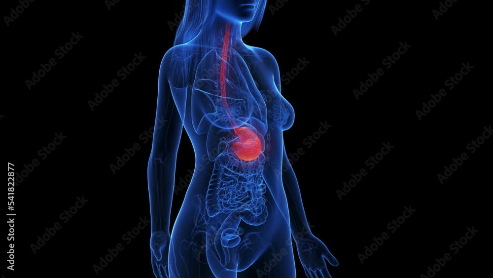 3d rendered medical animation of an inflamed stomach StockVideo