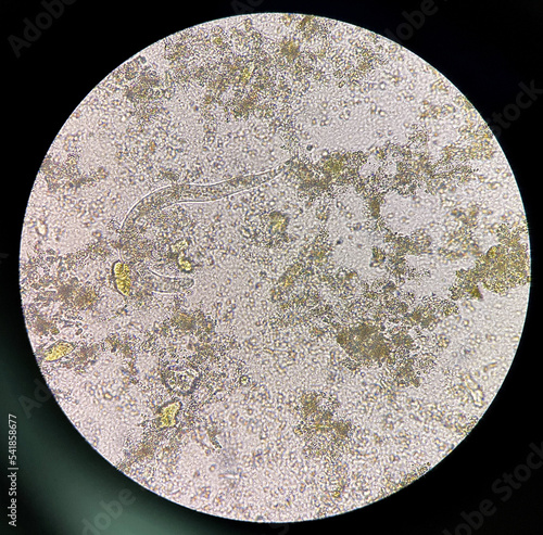 strongyloides stercoralis larva in stool exam. photo