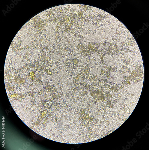 strongyloides stercoralis larva in stool exam. photo