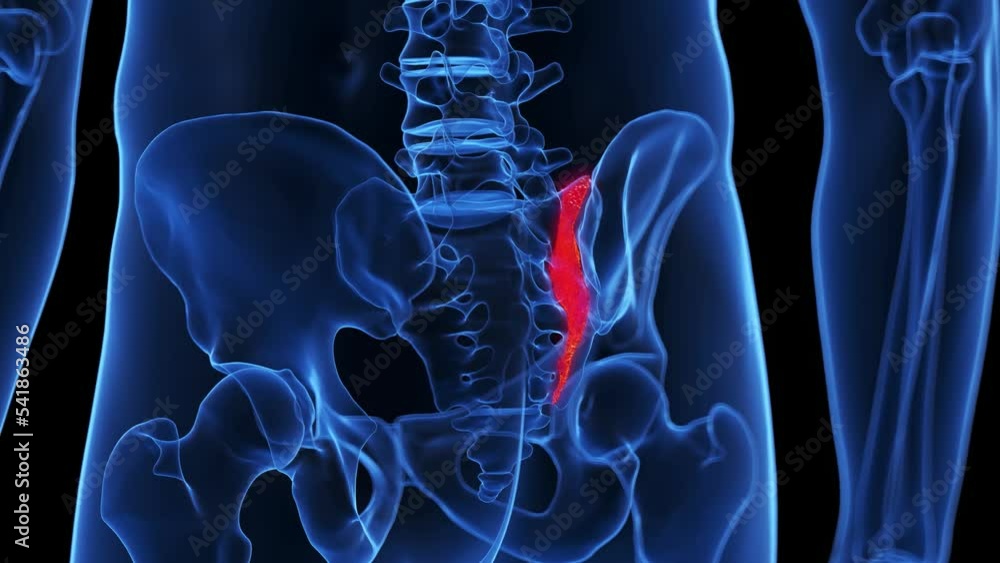3d rendered medical animation of a broken sacrum Stock Video Adobe Stock